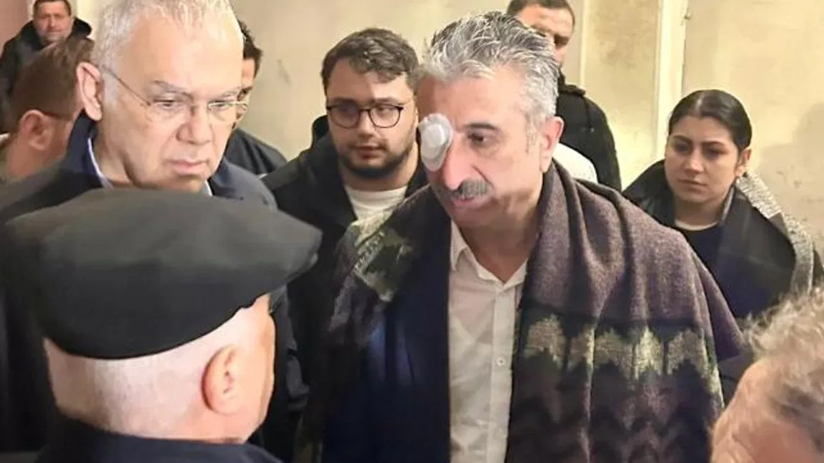 Bursa'daki eylemlerde CHP İl Başkanı yaralandı! Gözaltılar var