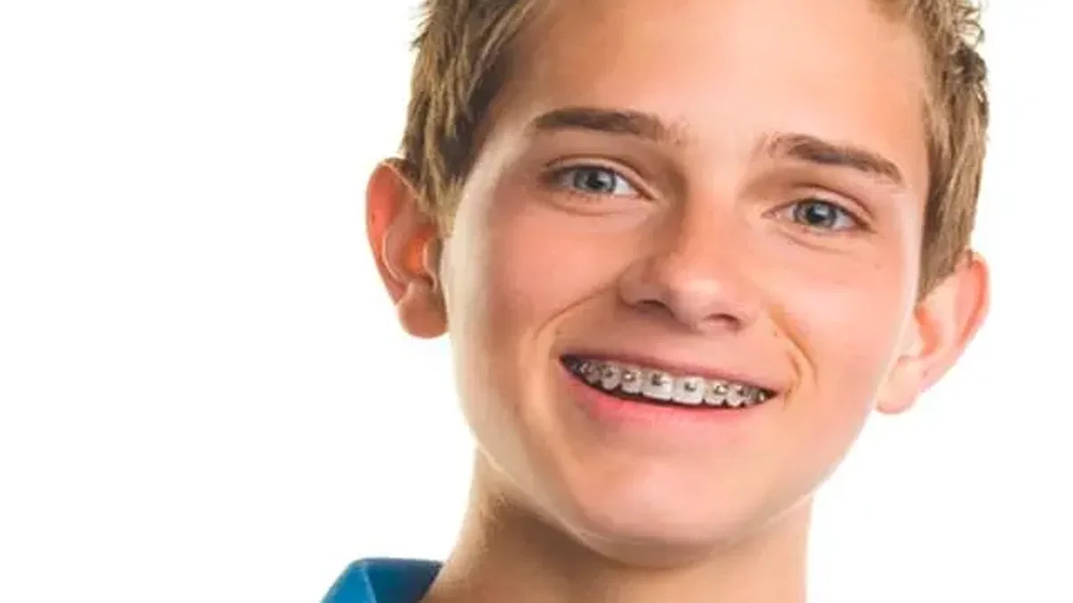 Çocuklarda invisalign tedavisinden sonra dikkat edilmesi gerekenler