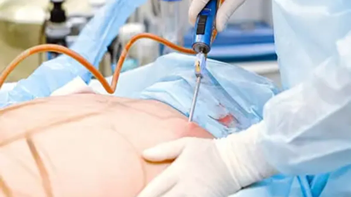 Liposuction: Vücut Şekillendirme ve Yağ Azaltma Cerrahisi